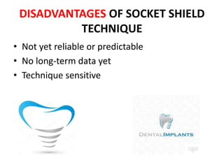 DISADVANTAGES OF SOCKET SHIELD
TECHNIQUE
• Not yet reliable or predictable
• No long-term data yet
• Technique sensitive
 