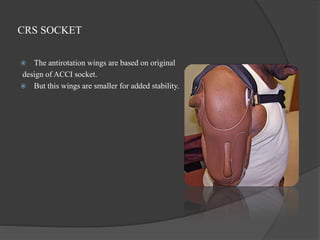 CRS SOCKET
 The antirotation wings are based on original
design of ACCI socket.
 But this wings are smaller for added stability.
 