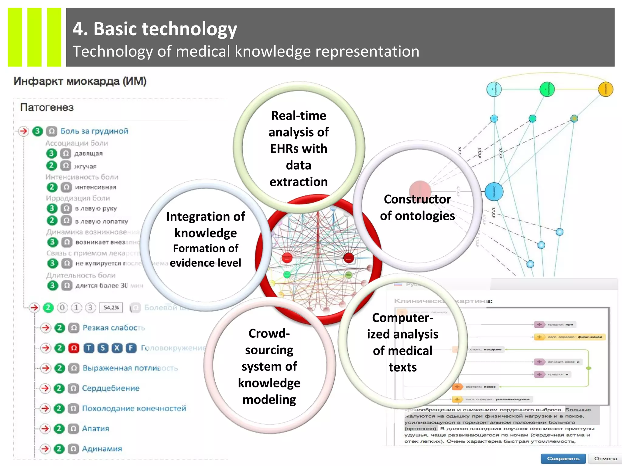 13
4. Basic technology
Technology of medical knowledge representation
Constructor
of ontologies
Crowd-
sourcing
system of
knowledge
modeling
Computer-
ized analysis
of medical
texts
Integration of
knowledge
Formation of
evidence level
Real-time
analysis of
EHRs with
data
extraction
 