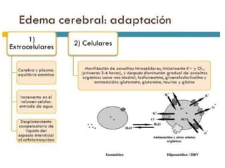 Na
Infundido - Na
Sérico
Agua CorporalTotal 1
Calcula el efecto que tendrá la infusión
de un litro de solución en el sodio sérico.
Hipo Na+: Principios
de Manejo
 