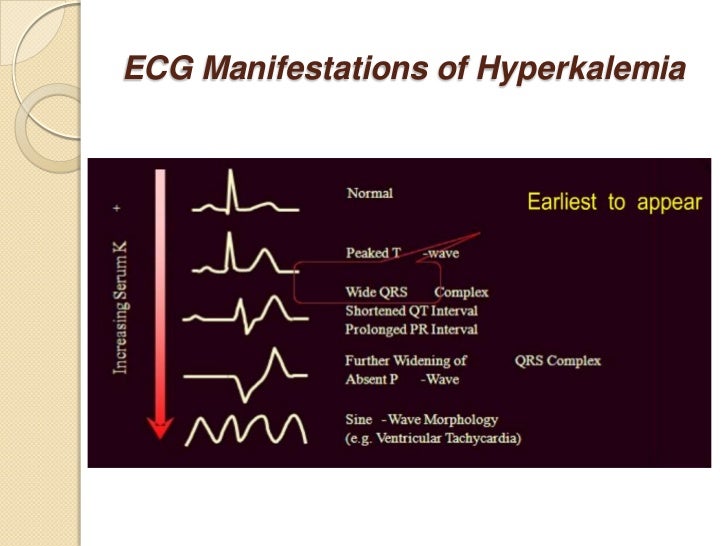 Sodium and Potassium Homeostasis in Neonates