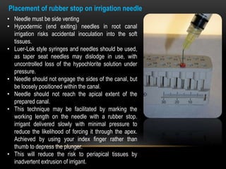 Placement of rubber stop on irrigation needle
• Needle must be side venting
• Hypodermic (end exiting) needles in root canal
irrigation risks accidental inoculation into the soft
tissues.
• Luer-Lok style syringes and needles should be used,
as taper seat needles may dislodge in use, with
uncontrolled loss of the hypochlorite solution under
pressure.
• Needle should not engage the sides of the canal, but
be loosely positioned within the canal.
• Needle should not reach the apical extent of the
prepared canal.
• This technique may be facilitated by marking the
working length on the needle with a rubber stop.
irrigant delivered slowly with minimal pressure to
reduce the likelihood of forcing it through the apex.
Achieved by using your index finger rather than
thumb to depress the plunger.
• This will reduce the risk to periapical tissues by
inadvertent extrusion of irrigant.
 