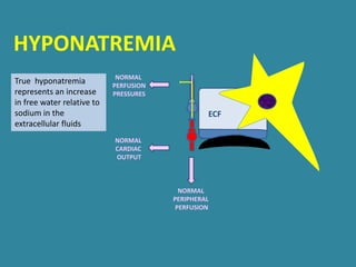 ECF
NORMAL
PERIPHERAL
PERFUSION
NORMAL
PERFUSION
PRESSURES
NORMAL
CARDIAC
OUTPUT
True hyponatremia
represents an increase
in free water relative to
sodium in the
extracellular fluids
HYPONATREMIA
 