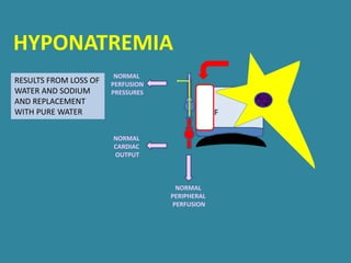 ECF
NORMAL
PERIPHERAL
PERFUSION
NORMAL
PERFUSION
PRESSURES
NORMAL
CARDIAC
OUTPUT
RESULTS FROM LOSS OF
WATER AND SODIUM
AND REPLACEMENT
WITH PURE WATER
HYPONATREMIA
 