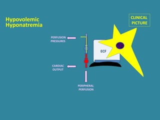 ECF
PERIPHERAL
PERFUSION
PERFUSION
PRESSURES
CARDIAC
OUTPUT
Hyponatremia
CLINICAL
PICTURE
Hypovolemic
 