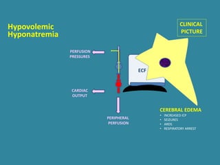 ECF
PERIPHERAL
PERFUSION
PERFUSION
PRESSURES
CARDIAC
OUTPUT
Hyponatremia
CLINICAL
PICTURE
Hypovolemic
CEREBRAL EDEMA
• INCREASED ICP
• SEIZURES
• ARDS
• RESPIRATORY ARREST
 