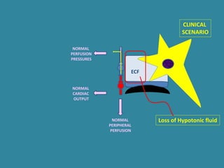 ECF
Loss of Hypotonic fluidNORMAL
PERIPHERAL
PERFUSION
NORMAL
PERFUSION
PRESSURES
NORMAL
CARDIAC
OUTPUT
CLINICAL
SCENARIO
 