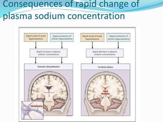 Consequences of rapid change of
plasma sodium concentration
 