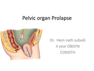 Pelvic organ Prolapse
Dr. Hem nath subedi
II year OBGYN
COMSTH
 