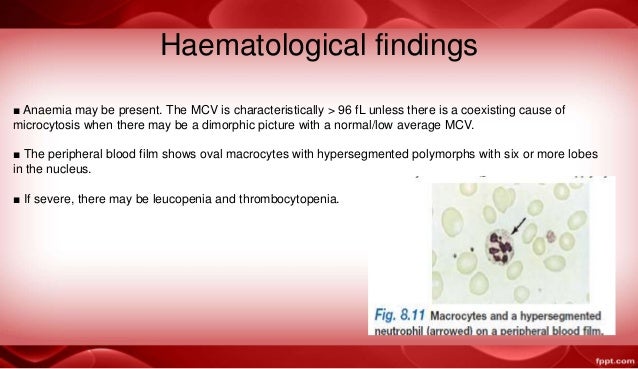 Macrocytic Anemia