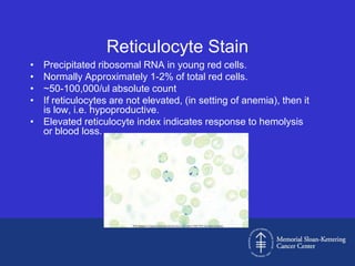 approach to the diagnosis of anemia | PPTX