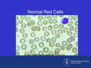 approach to the diagnosis of anemia | PPTX