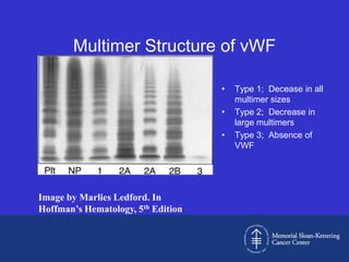 Multimer Structure of vWF

                                    •   Type 1; Decease in all
                                        multimer sizes
                                    •   Type 2; Decrease in
                                        large multimers
                                    •   Type 3; Absence of
                                        VWF




Image by Marlies Ledford. In
Hoffman’s Hematology, 5th Edition
 
