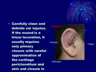 Carefully clean and debride ear injuries. If the wound is a linear laceration, it usually requires only primary closure with careful approximation of the cartilage perichondrium and skin and closure in 3 layers, using 5-0 nonabsorbable sutures for the skin layer.  Tragus Antitragus Antihelix Hematoma 