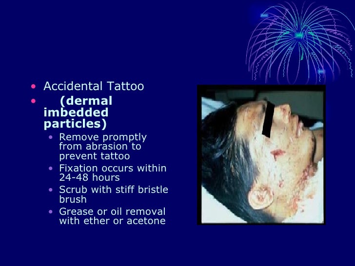 Soft Tissue Facial Injuries By Sa