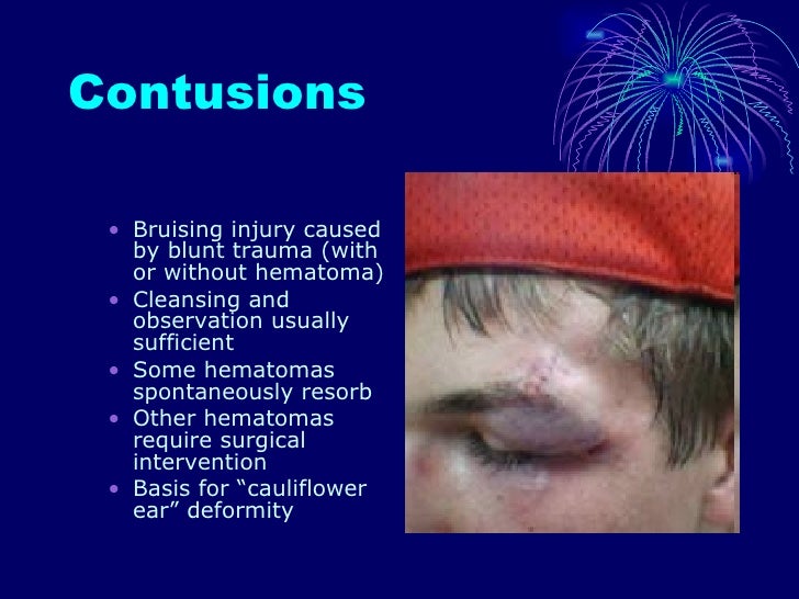 Soft Tissue Facial Injuries By Sa