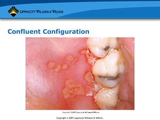 Soft Tissue Lesions | PPT