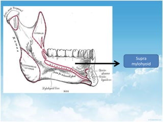  in intensity Cellulitis is a example of Connective tissue painAn acute, diffuse, and suppurative inflammation of loose connective tissue, particularly the deep subcutaneous tissues, and sometimes muscle, which is most commonly seen as a result of infection of a wound, ulcer, or other skin lesions.