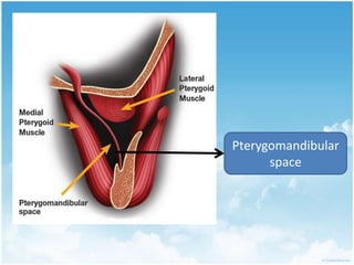 Confinement inflammatory exudate  Acute cellulitis – swelling and pain 