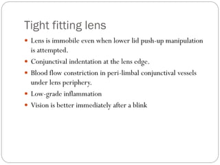 Tight fitting lens
 Lens is immobile even when lower lid push-up manipulation
is attempted.
 Conjunctival indentation at the lens edge.
 Blood flow constriction in peri-limbal conjunctival vessels
under lens periphery.
 Low-grade inflammation
 Vision is better immediately after a blink
 