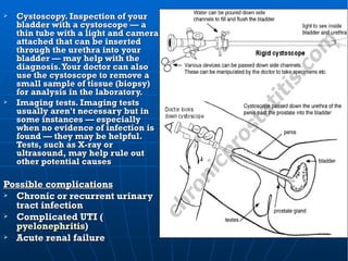 URINARY SYSTEM DISORDERS of ROBB, FILAMER | PPT