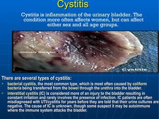 Cystitis <ul><li>There are several types of cystitis: </li></ul><ul><li>bacterial cystitis , the most common type, which i...
