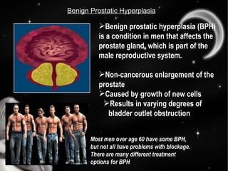Benign Prostatic Hyperplasia Most men over age 60 have some BPH, but not all have problems with blockage. There are many d...