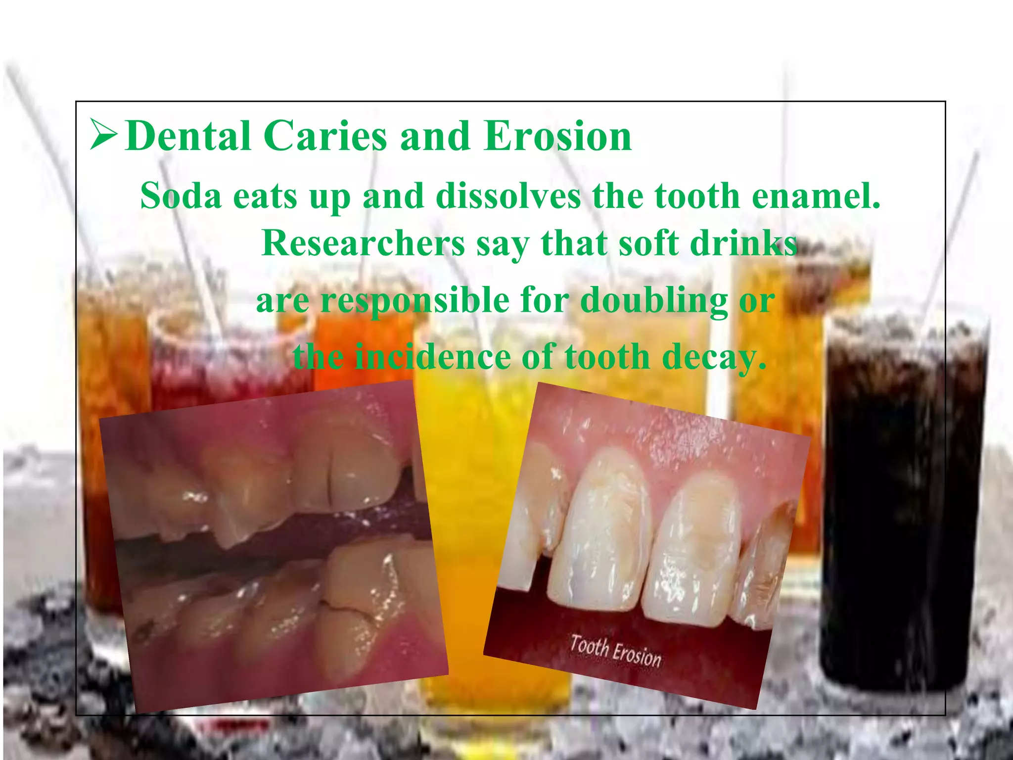 Dental Caries and Erosion
Soda eats up and dissolves the tooth enamel.
Researchers say that soft drinks
are responsible for doubling or
the incidence of tooth decay.

 