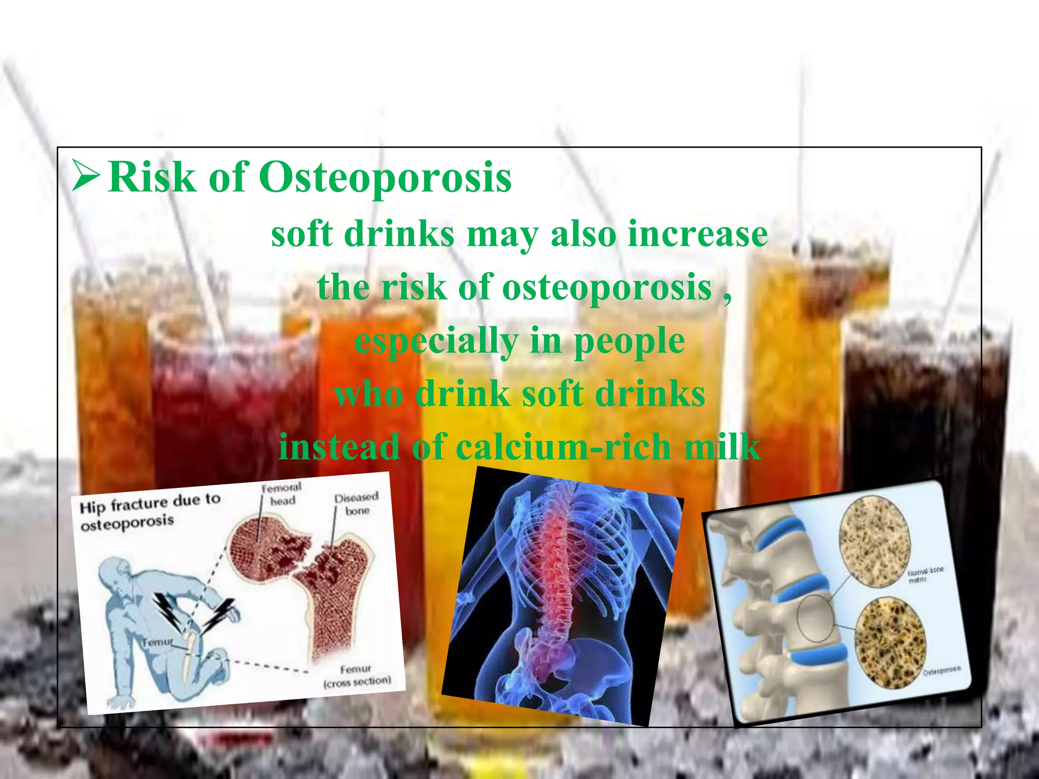 Risk of Osteoporosis
soft drinks may also increase
the risk of osteoporosis ,
especially in people
who drink soft drinks
instead of calcium-rich milk

 