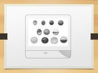 Ovals
 