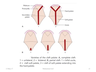 13-May-17 21Muhammed Asif
 
