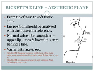 Ricketts Line soft tissue analysis - Copy.pptx