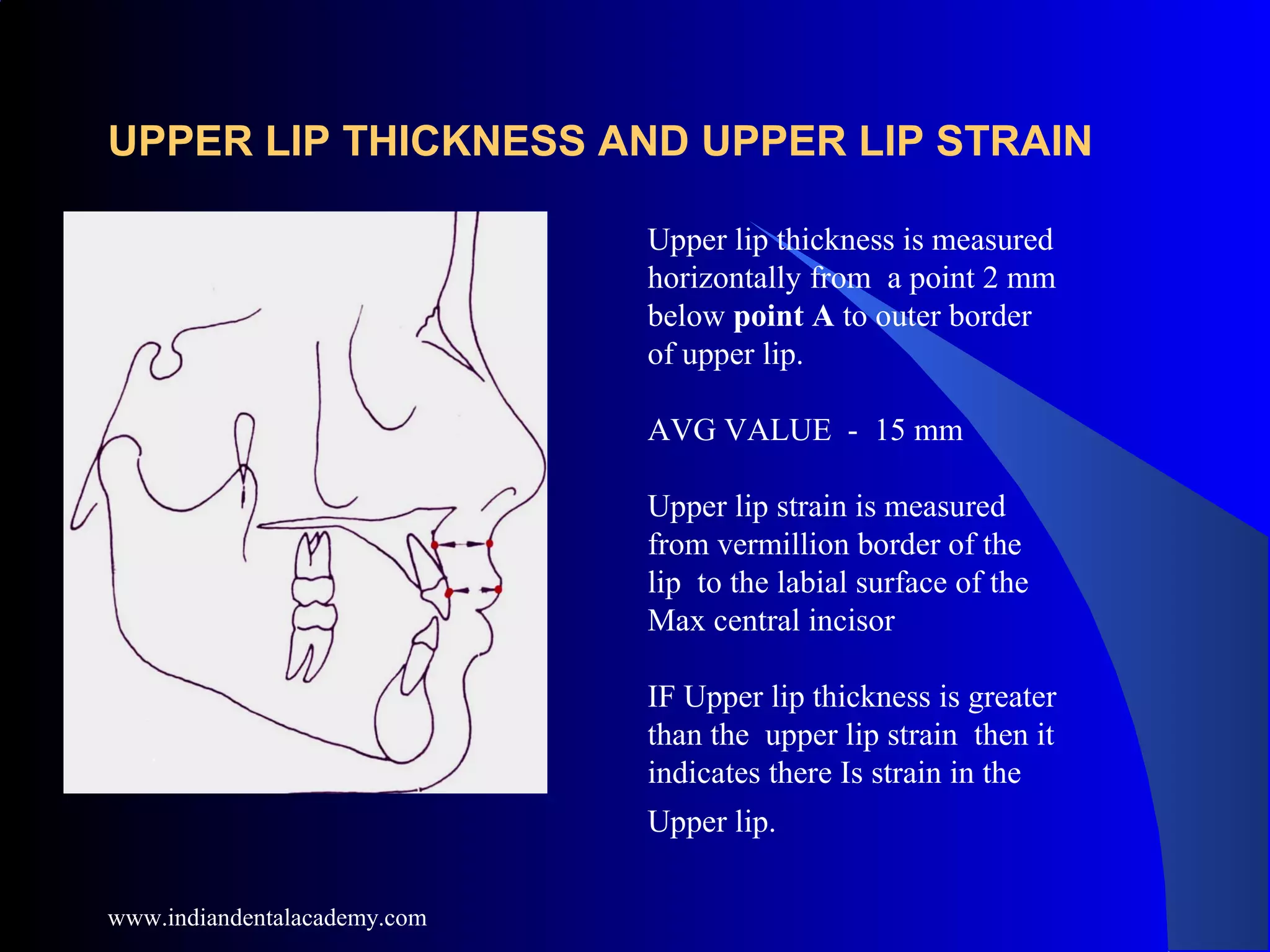 UPPER LIP THICKNESS AND UPPER LIP STRAIN
Upper lip thickness is measured
horizontally from a point 2 mm
below point A to outer border
of upper lip.
AVG VALUE - 15 mm
Upper lip strain is measured
from vermillion border of the
lip to the labial surface of the
Max central incisor
IF Upper lip thickness is greater
than the upper lip strain then it
indicates there Is strain in the
Upper lip.
www.indiandentalacademy.com
 