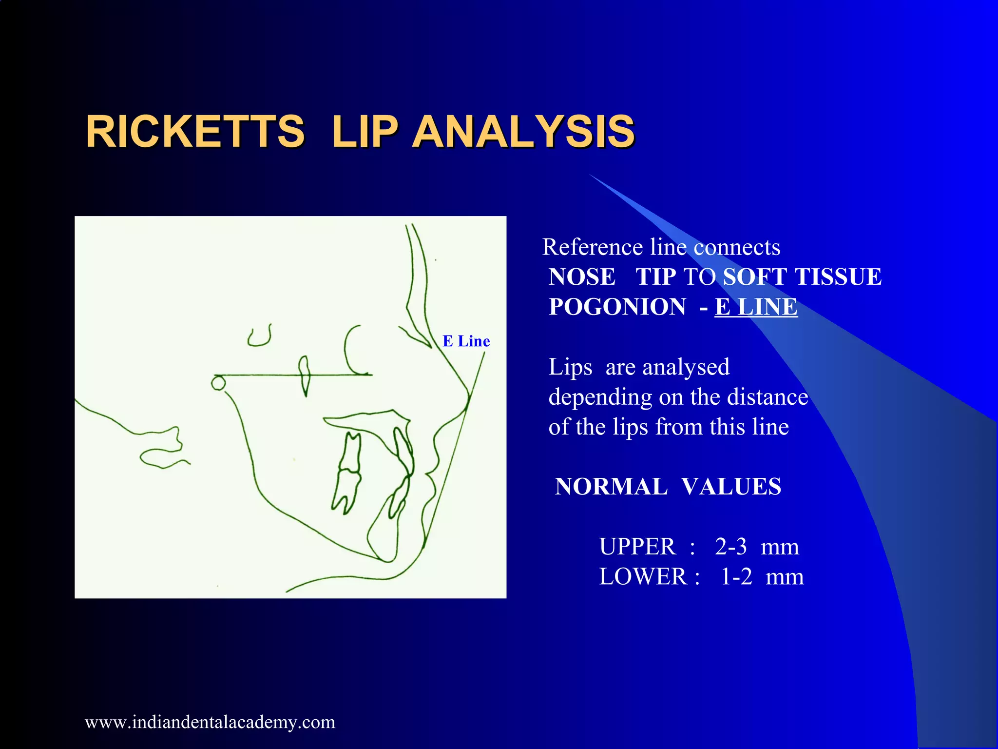 RICKETTS LIP ANALYSISRICKETTS LIP ANALYSIS
E Line
Reference line connects
NOSE TIP TO SOFT TISSUE
POGONION - E LINE
Lips are analysed
depending on the distance
of the lips from this line
NORMAL VALUES
UPPER : 2-3 mm
LOWER : 1-2 mm
www.indiandentalacademy.com
 