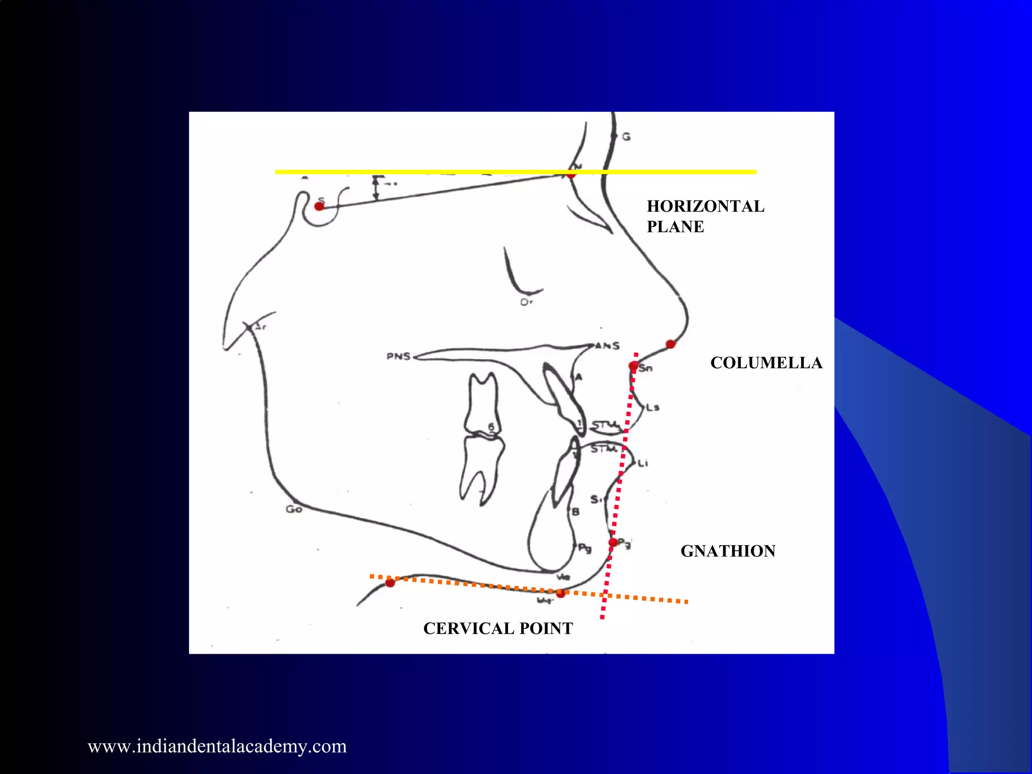 HORIZONTAL
PLANE
COLUMELLA
GNATHION
CERVICAL POINT
www.indiandentalacademy.com
 