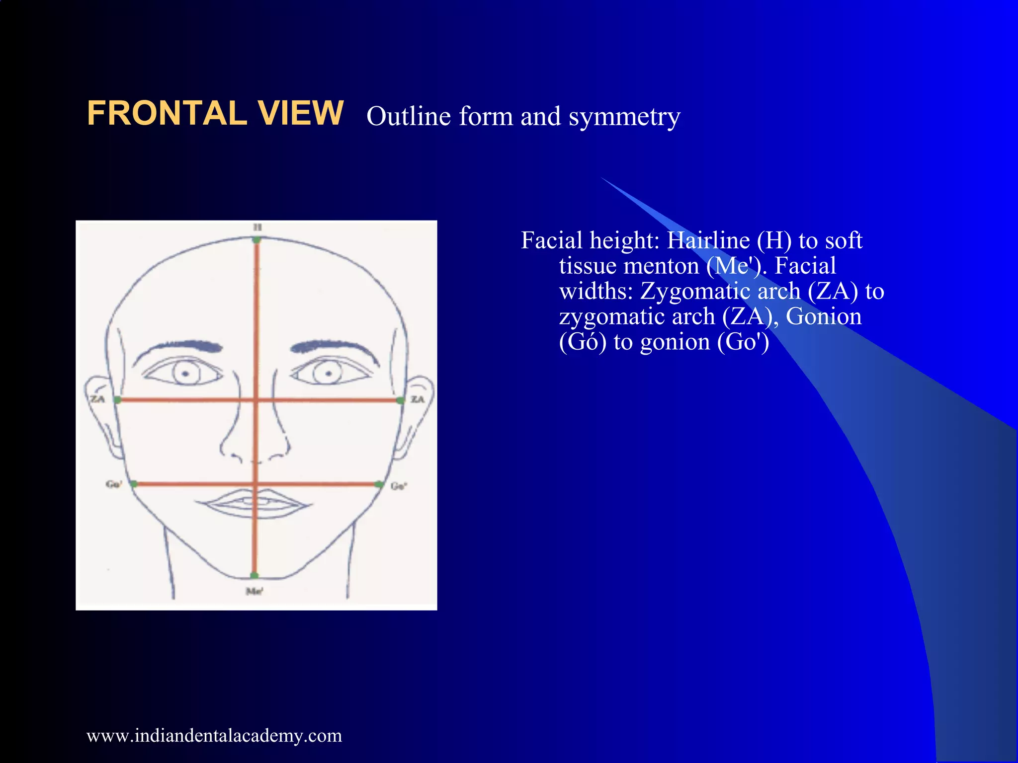 FRONTAL VIEW
Facial height: Hairline (H) to soft
tissue menton (Me'). Facial
widths: Zygomatic arch (ZA) to
zygomatic arch (ZA), Gonion
(Gó) to gonion (Go')
Outline form and symmetry
www.indiandentalacademy.com
 