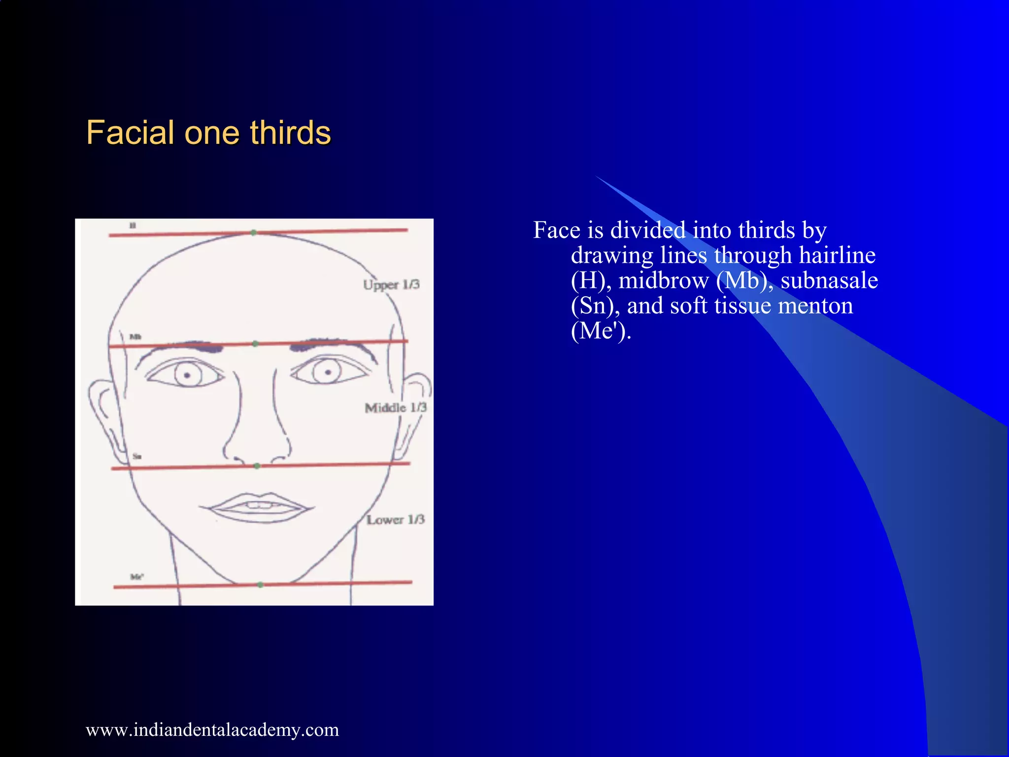 Facial one thirdsFacial one thirds
Face is divided into thirds by
drawing lines through hairline
(H), midbrow (Mb), subnasale
(Sn), and soft tissue menton
(Me').
www.indiandentalacademy.com
 
