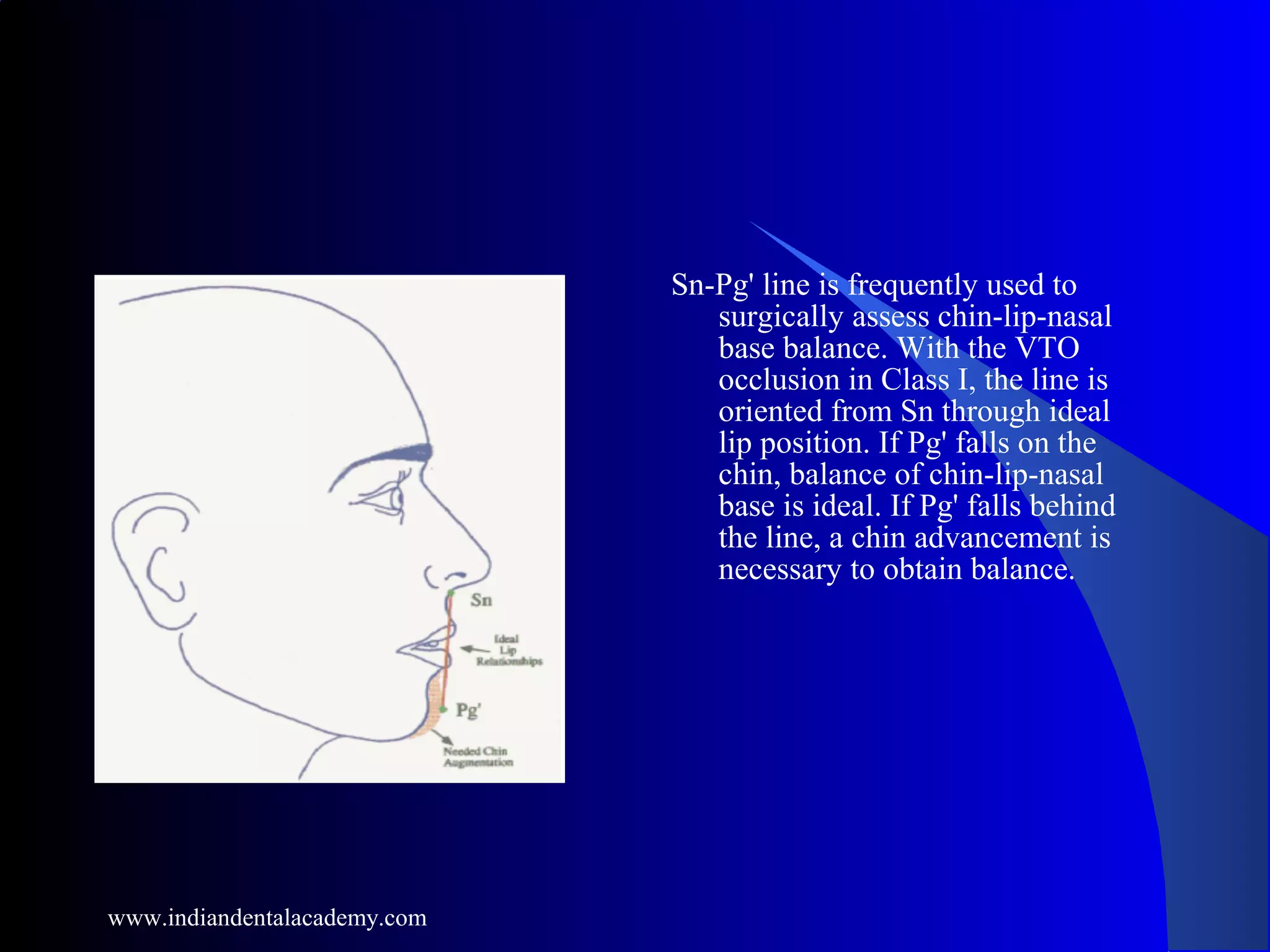 Sn-Pg' line is frequently used to
surgically assess chin-lip-nasal
base balance. With the VTO
occlusion in Class I, the line is
oriented from Sn through ideal
lip position. If Pg' falls on the
chin, balance of chin-lip-nasal
base is ideal. If Pg' falls behind
the line, a chin advancement is
necessary to obtain balance.
www.indiandentalacademy.com
 