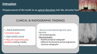 Apical Direction management of oral soft tissue injuries and luxation.pptx