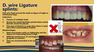 management of oral soft tissue injuries and luxation.pptx