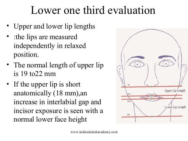 What Is The Normal Mm For A Short Box Beard | soft tissue based diagnosis and treatment planning What Is The Normal Mm For A Short Box Beard | soft tissue based diagnosis and treatment planning