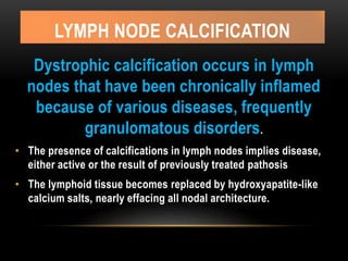 LYMPH NODE CALCIFICATION
Dystrophic calcification occurs in lymph
nodes that have been chronically inflamed
because of various diseases, frequently
granulomatous disorders.
• The presence of calcifications in lymph nodes implies disease,
either active or the result of previously treated pathosis
• The lymphoid tissue becomes replaced by hydroxyapatite-like
calcium salts, nearly effacing all nodal architecture.
 