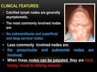 CLINICAL FEATURES:
• Calcified lymph nodes are generally
asymptomatic,
• The most commonly involved nodes
are:
• the submandibular and superficial
and deep cervical nodes.
• Less commonly involved nodes are:
• the preauricular and submental nodes are
involved.
• When these nodes can be palpated, they are hard,
lumpy, round to oblong masses.
 