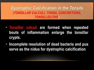 (TONSILLAR CALCULI, TONSIL CONCRETIONS,
TONSILLOLITHS)
• Tonsillar calculi are formed when repeated
bouts of inflammation enlarge the tonsillar
crypts.
• Incomplete resolution of dead bacteria and pus
serve as the nidus for dystrophic calcification.
 