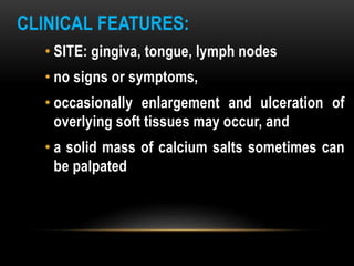 CLINICAL FEATURES:
• SITE: gingiva, tongue, lymph nodes
• no signs or symptoms,
• occasionally enlargement and ulceration of
overlying soft tissues may occur, and
• a solid mass of calcium salts sometimes can
be palpated
 