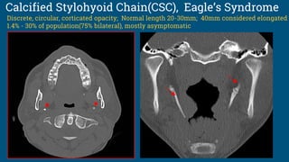 Calcified Stylohyoid Chain(CSC), Eagle’s Syndrome
Discrete, circular, corticated opacity; Normal length 20-30mm; 40mm considered elongated
1.4% - 30% of population(75% bilateral), mostly asymptomatic
 