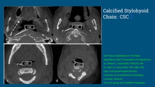 Soft Tissue Calcifications In The Neck:
Maxillofacial CBCT Presentation And Significance
Dr. William C. Scarfe BDS, FRACDS, MS
Dr. Allan G. Farman BDS, PhD, MBA, DSc
Dept. of Surgical/Hospital Dentistry
University of Louisville School of Dentistry
Louisville, Kentucky
From the Spring 2010 AADMRT Newsletter
Calcified Stylohyoid
Chain: CSC
 