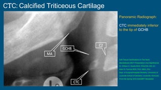 CTC: Calcified Triticeous Cartilage
Soft Tissue Calcifications In The Neck:
Maxillofacial CBCT Presentation And Significance
Dr. William C. Scarfe BDS, FRACDS, MS, Dr.
Allan G. Farman BDS, PhD, MBA, DSc
Dept. of Surgical/Hospital Dentistry, University of
Louisville School of Dentistry, Louisville, Kentucky
From the Spring 2010 AADMRT Newsletter
Panoramic Radiograph:
CTC immediately inferior
to the tip of GCHB
 