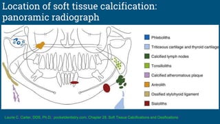 Location of soft tissue calcification:
panoramic radiograph
Laurie C. Carter, DDS, Ph.D, pocketdentistry.com, Chapter 28, Soft Tissue Calcifications and Ossifications
 