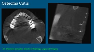 Osteoma Cutis
Dr. Shawneen Gonzalez, Director of Radiology, Legacy 3D Imaging
 